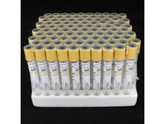 黄色管帽含促凝剂及分离胶PET材质真空采血管_抽血管